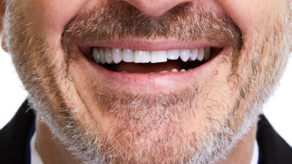 cirkon-fog-budapest-580x325