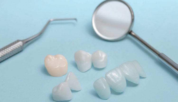 fémmentes-keramia-korona-keszitese