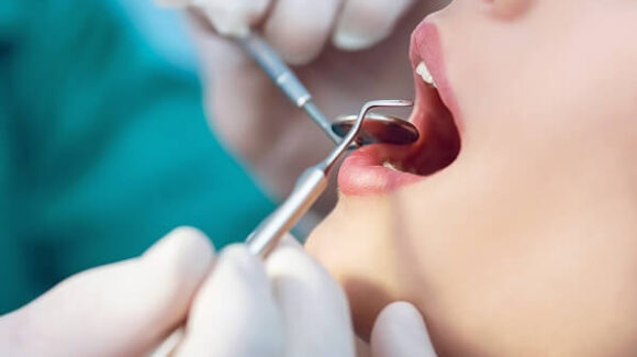 csontpotlas-tervezese-fogbeultetes-elott-580x325