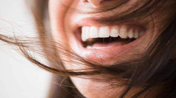 esztetikus-mosoly-ideiglenes-fogpotlas-utan-580x325