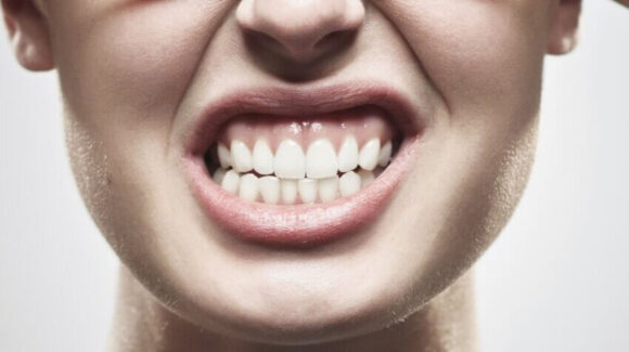 fogcsikorgatas-fogszoritas-580x325