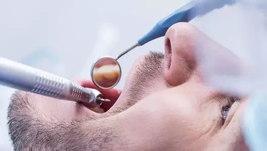 fogpotlas-arak-foghuzas-utan