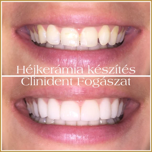 hejkeramia-elonyei-580x580