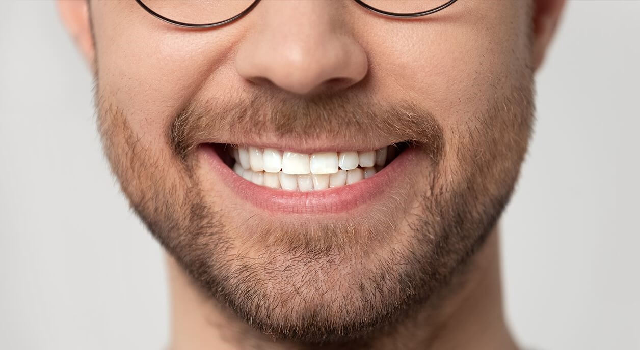 iranyitott-implantacio-utan