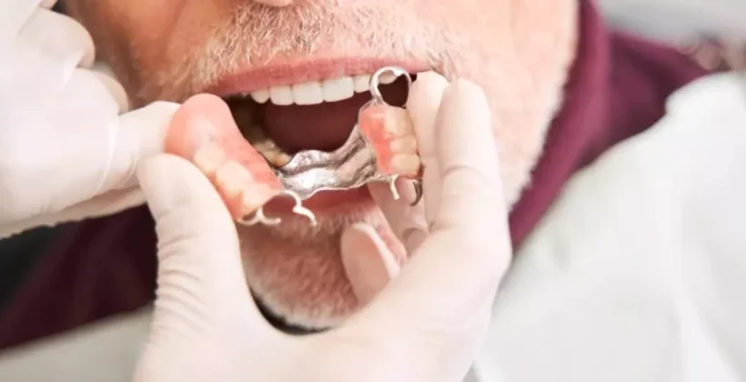 kapcsos-fogsor-kivetele-820x420