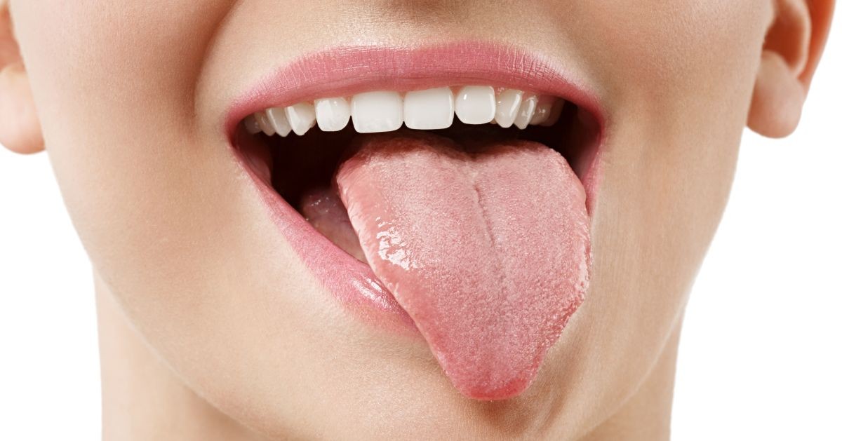 lepedékes-nyelv-milyen-problémát-jelez