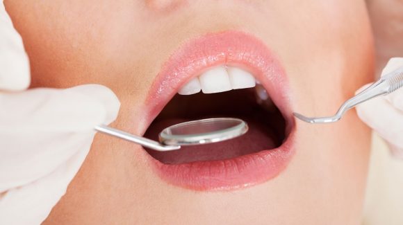 mitol-fajhat-egy-ep-fog-580x325