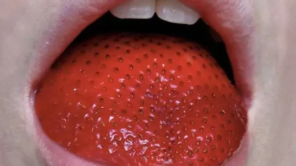 nyelv-betegsegek-foltok-a-nyelven-580x325