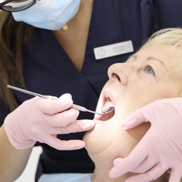 szajapolas-ellenorzese-fogorvossal-580x580